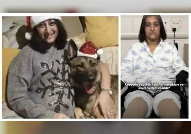 വളര്‍ത്തുനായ മുറിവില്‍ നക്കിയതിനെതുടർന്നു  56 -കാരിക്ക് ആറ് ഹൃദയസ്തംഭനം, ഒടുവില്‍ കൈകാലുകള്‍ മുറിച്ചു മാറ്റി